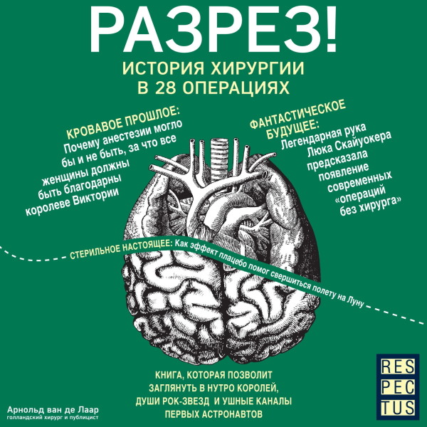Разрез! История хирургии в 28 операциях - Ван Де Лаар Арнольд